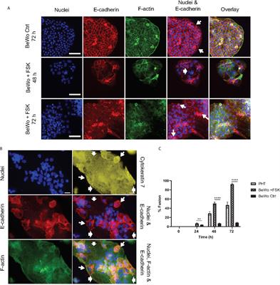 Human Placental Trophoblasts Infected by Listeria monocytogenes Undergo a Pro-Inflammatory Switch Associated With Poor Pregnancy Outcomes